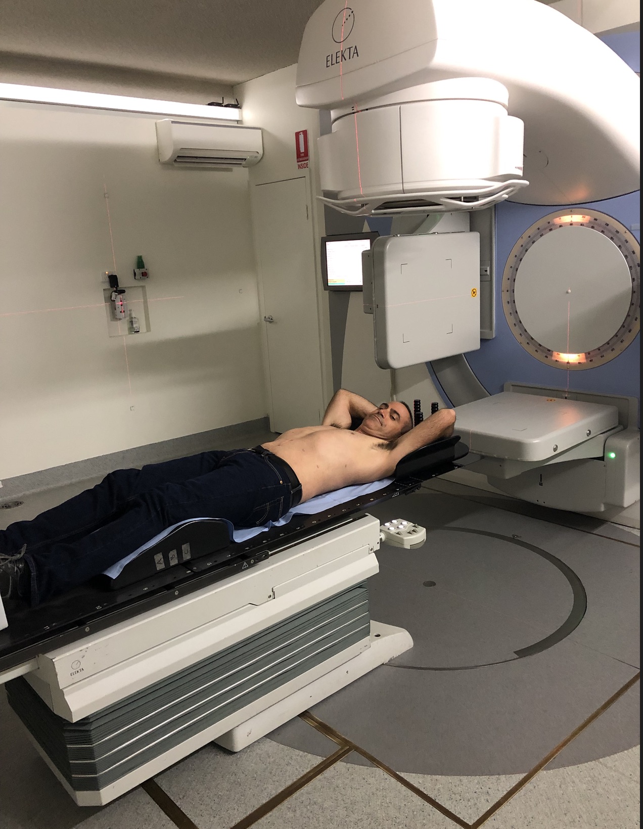 Radiation Ends – now the wait.